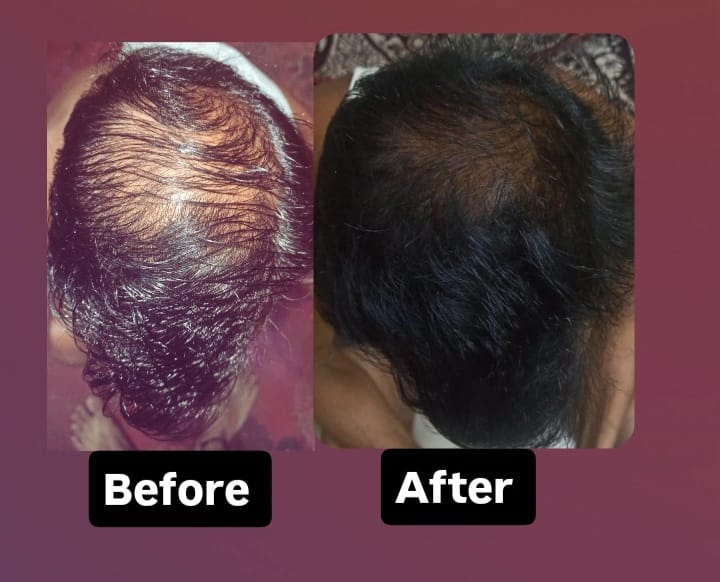 Soil Essence Gold Herbal Oil & Shampoo