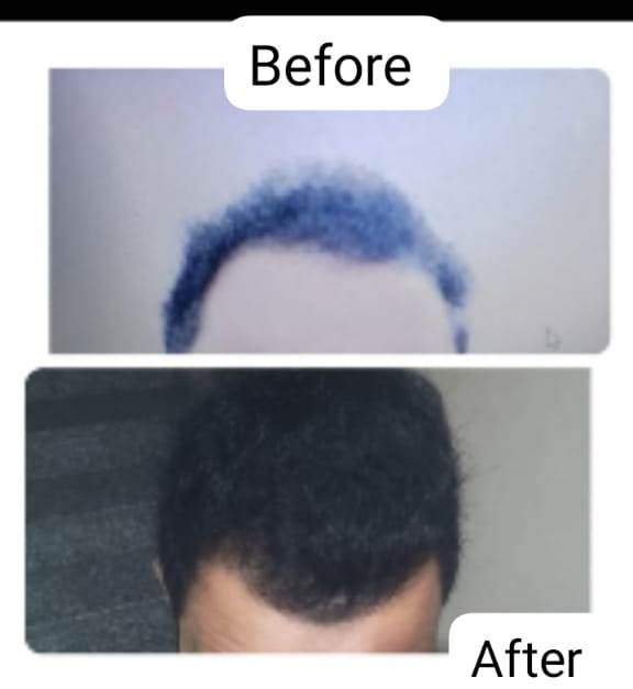 Soil Essence Gold Herbal Oil & Shampoo